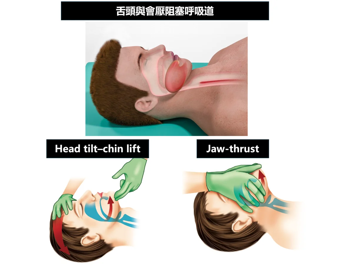 T01 圖 1